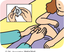 Pose de la crème anesthésiante