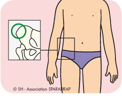 Le myelogramme se fait dans l'os du bassin appellé l'épine iliaque ou parfois dans l'os du sternum.