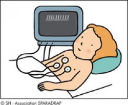 cardioscope
